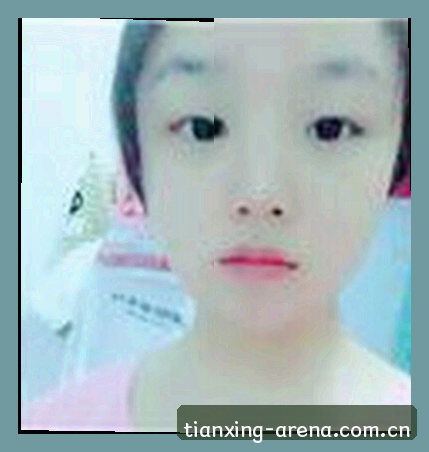 孙婷